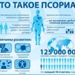 Некрасиво, но не заразно: специалист из Добруша –  о псориазе