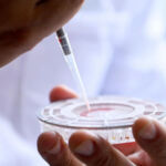 Российские ученые создали первый в мире быстрый тест для диагностики гепатита С